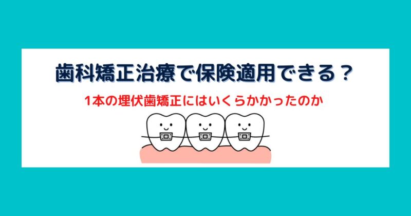 矯正歯科治療で保険適用される場合はある？埋伏歯の矯正にかかった費用